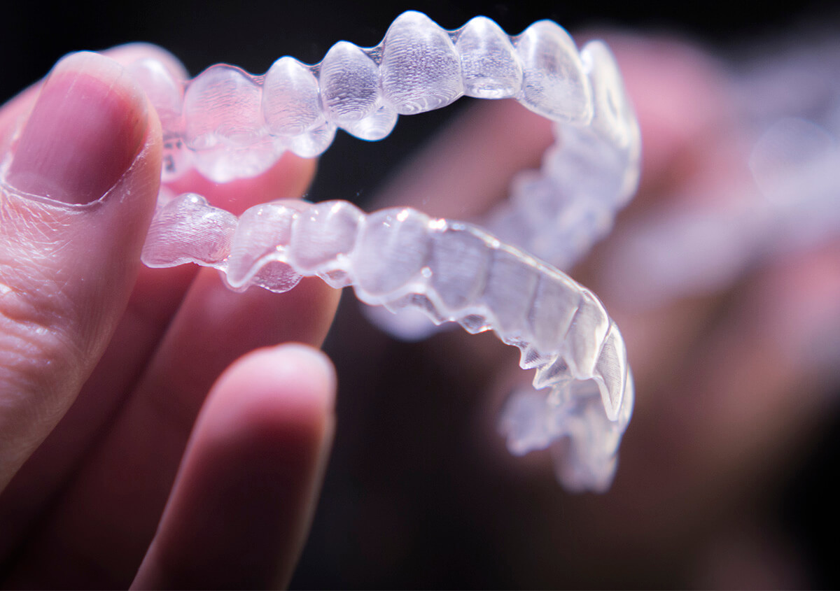 5 benefits of invisible aligners vs braces to straighten teeth