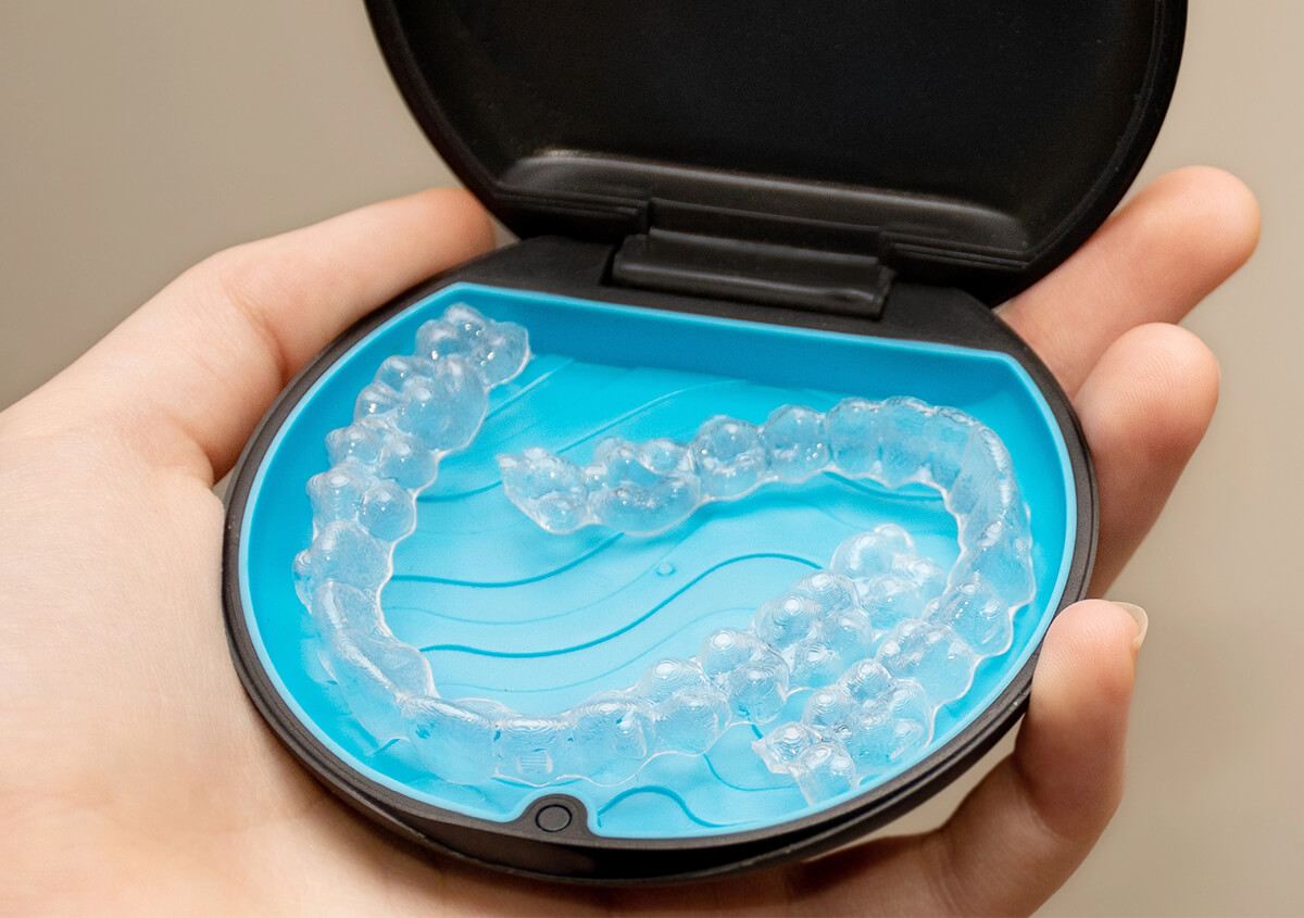 5 Myths About Clear Aligners Debunked: What You Need to Know in Edmond, OK