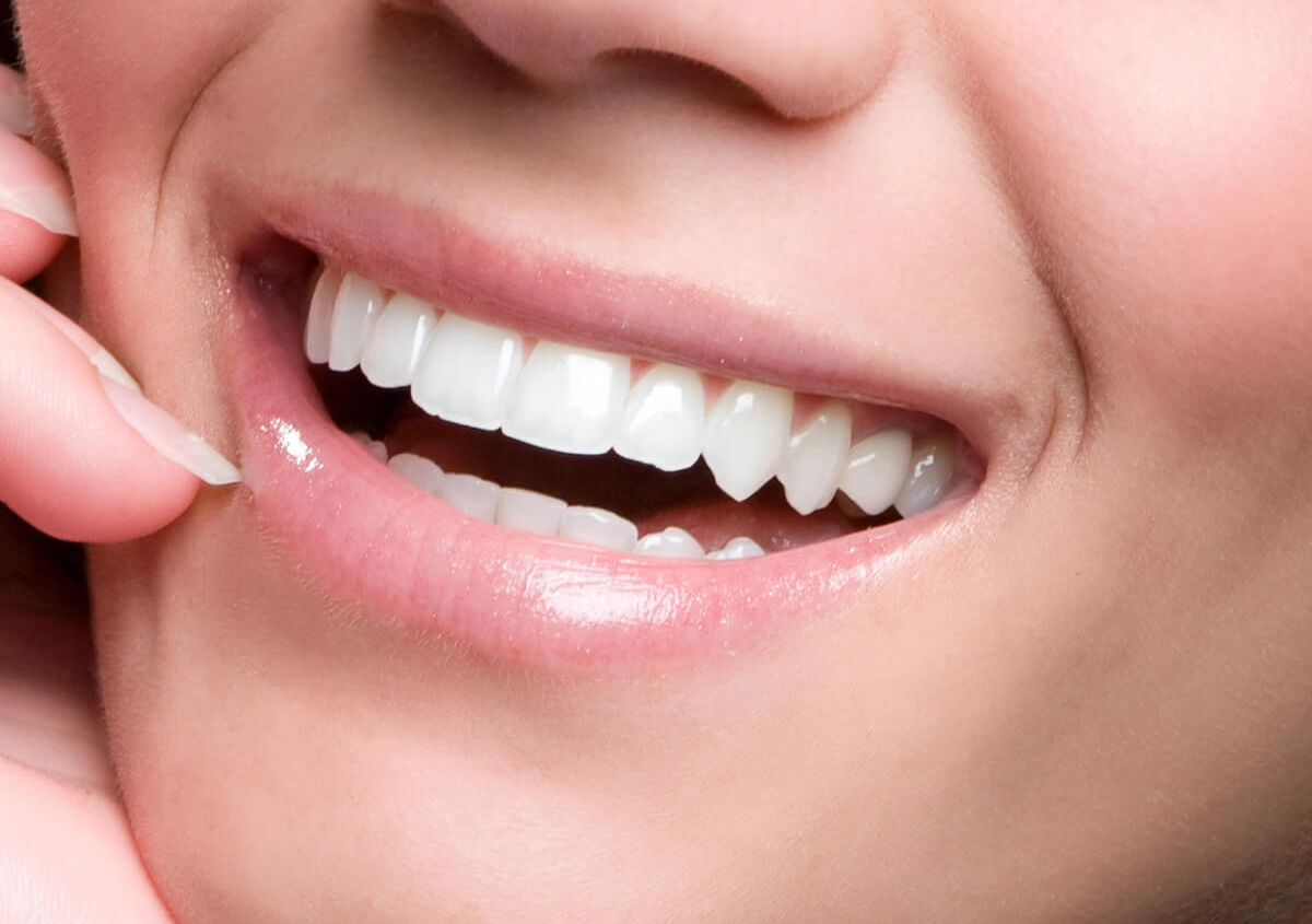 Veeners for Your Teeth in Edmond OK Area
